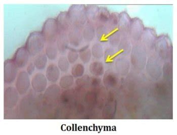 Types of Collenchyma | EasyBiologyClass