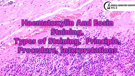 Hematoxylin and Eosin (H&E) Staining, Classification, Principle, Procedure, Interpretations