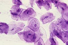 Human stained cheek cells, squamous epithelium. LM X100. | Cell biology, Health, wellbeing ...