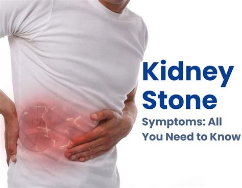 Kidney Stone Symptoms: All You Need to Know - Dr. Mulay Superspeciality Hospital