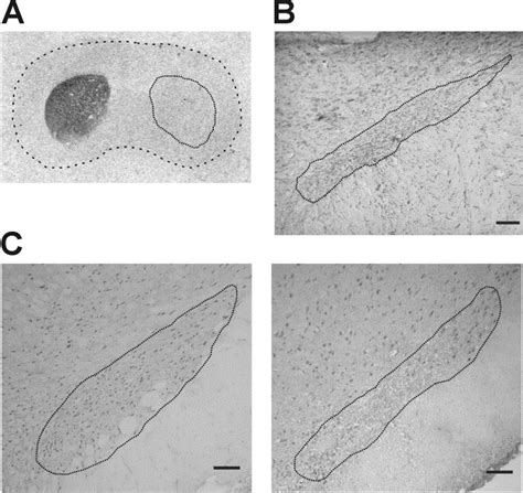 Subthalamic nucleus lesion reverses motor abnormalities and striatal ...