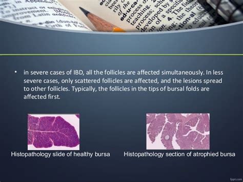 Gumboro_Disease Infectious Bursal Disease (IBD)