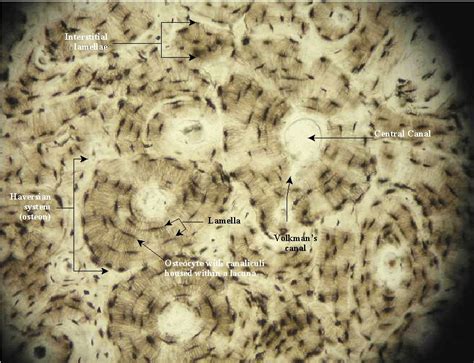 Bone Connective Tissue