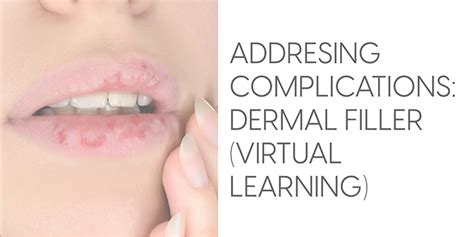 Addressing Complications: Dermal Fillers | Aesthetic Medical Partners