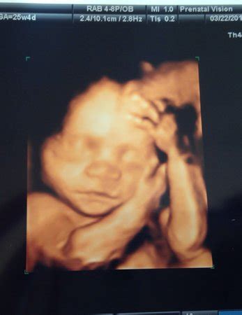 25 weeks 4 days 3D ultrasound! | BabyCenter