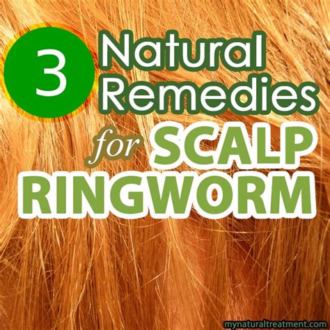 77 Best of Can You Get A Haircut With Ringworm - Haircut Trends