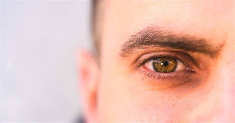 Eye Freckles: Causes, Symptoms, Complications, and Treatments