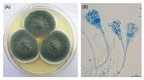 Penicillium Colony Morphology