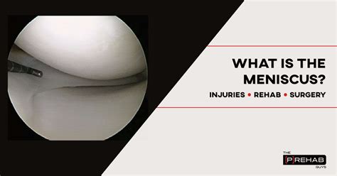 What is a Meniscus Injury? Learn About Meniscus Surgery Rehab – [𝗣]𝗥𝗲𝗵𝗮𝗯