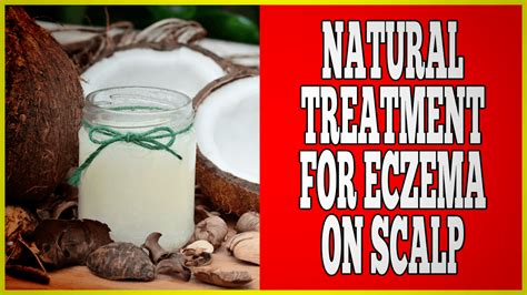 Natural Treatment For Eczema On Scalp - Clinton Conley