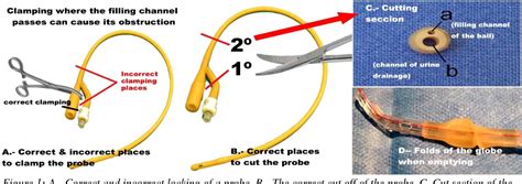 Figure 1 from Algorithm Proposal to Remove a Non-Deflatable Bladder ...