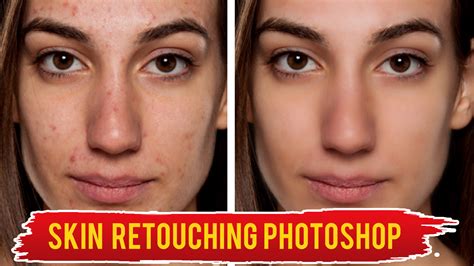 skin retouching, face, acne, photo editing photoshop tutorial - White Dot Academy