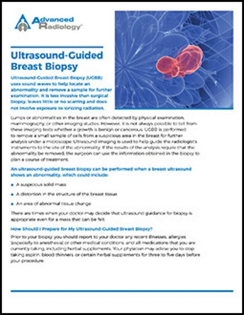 Advanced Radiology Consultants: Ultrasound-Guided Breast Biopsy