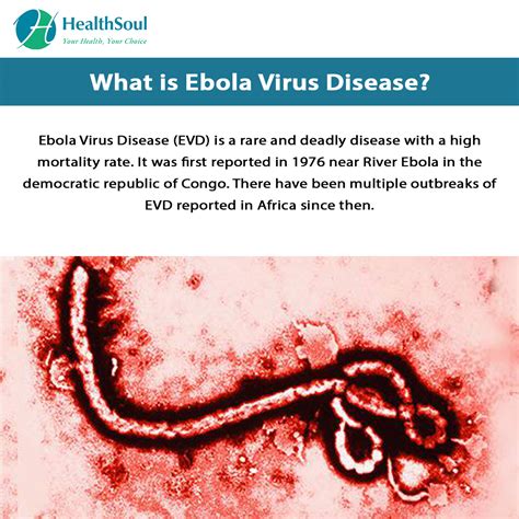 Ebola Virus Disease: Symptoms and Treatment – Healthsoul