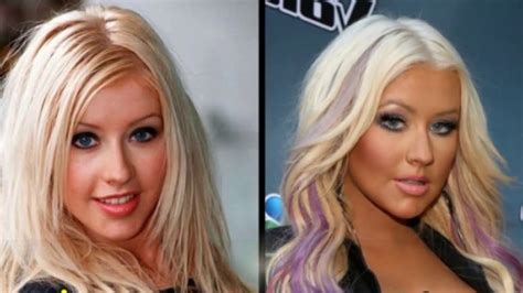 49 Celebrities Before and After Plastic Surgery - YouTube