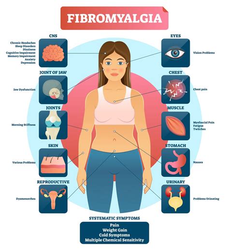 What happens if fibromyalgia is left untreated?