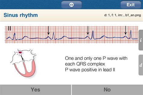 ECG Analysis iPhone and iPad medical app review