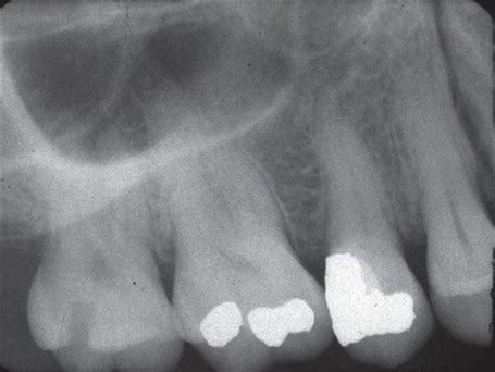 X rays at the dentist, what you should know. - Online Dentists