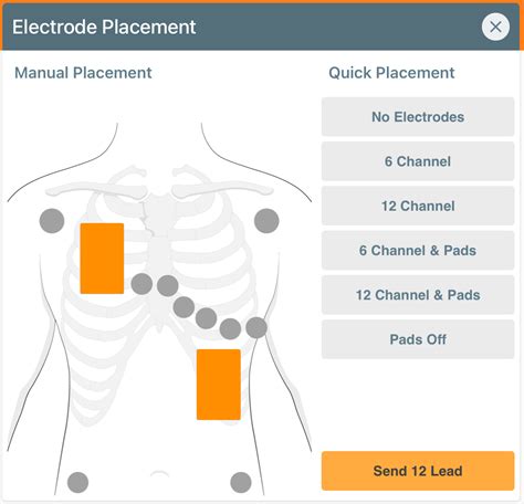 Control - Section 2: Electrode placement and AED screens – iSimulate