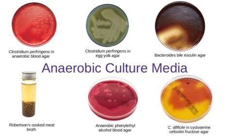 Anaerobic Culture Media • Microbe Online