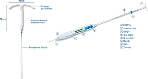 Copper Iud Insertion