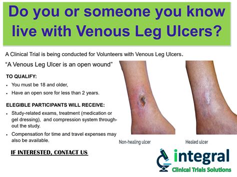 Venous Leg Ulcer - Homestead FL (Metro Miami) (Clinical Trial # 43409)