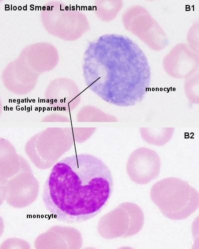 Monocyte on a smear | Medical Laboratories