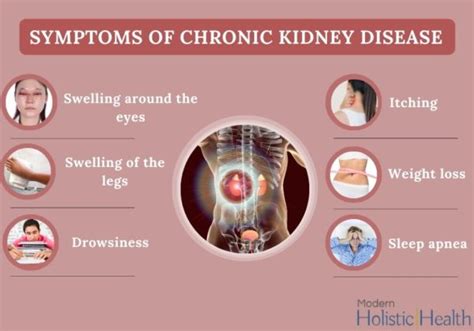 Chronic Kidney Disease – A Warning Sign for Millions