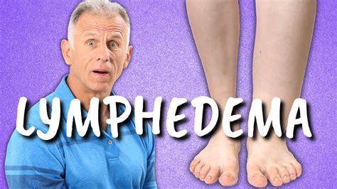 10 Exercises for Leg Lymphedema (Swelling or Edema of the Lower Extremities) - YouTube