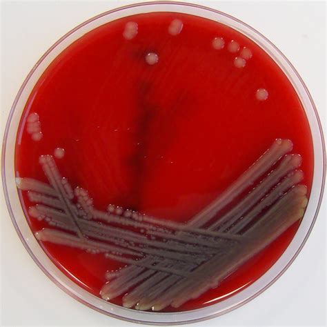 Aeromonas hydrophila on Columbia Horse Blood Agar | Aeromona… | Flickr