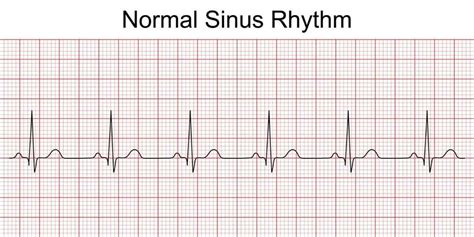 Electrocardiogram (ECG or EKG) in Singapore