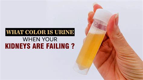 Kidney Failure Urine Color