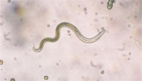 Examples of Nematodes | Sciencing