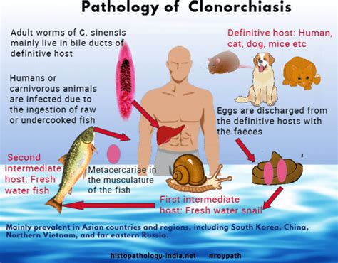 Pathology of Clonorchiasis - Dr Sampurna Roy MD