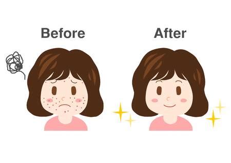 before and after clipart 20 free Cliparts | Download images on Clipground 2024