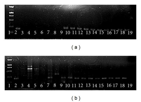 Agarose gel electrophoresis of SYBR Green real-time PCR products of ...