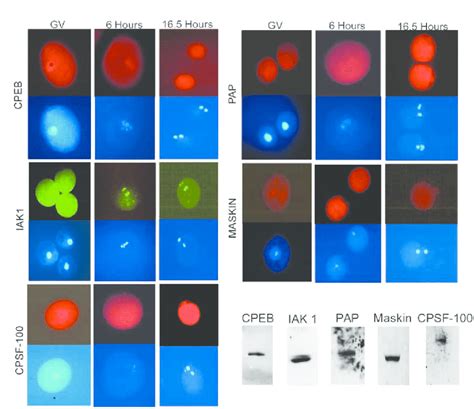 Immunohistochemistry of polyadenylation/translation factors in maturing... | Download Scientific ...