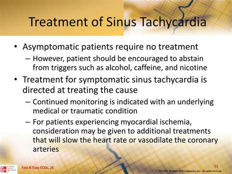 PPT - Sinus Dysrhythmias PowerPoint Presentation - ID:3345190