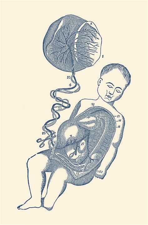 Baby and Placenta - Placenta Removal - Vintage Anatomy Drawing by Vintage Anatomy Prints - Fine ...