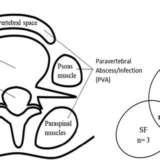 Schematic of the four PSI types and location (left) and Venn diagram... | Download Scientific ...