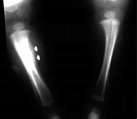 Positioning - Forensic Radiology - Barnard Health Care