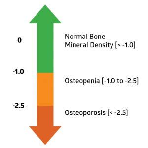 DEXA Scan - Scores & Everything You Need to Know | AlgaeCal