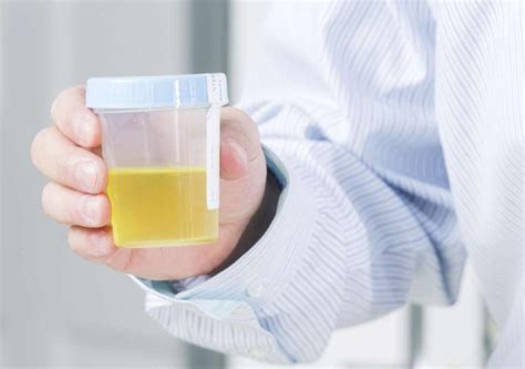 Why Do You See White Particles in Urine? - Healthwire