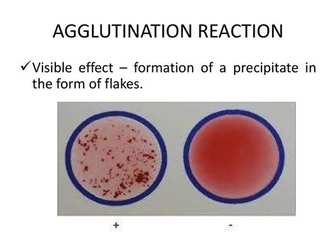 Serology. Immunity reactions agglutination, precipitation and immunofluorescence reactions ...