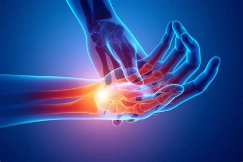 Hand & Wrist Pain Specialist - Palm Harbor, FL: Orthopedic Specialists: Orthopedic Surgeon