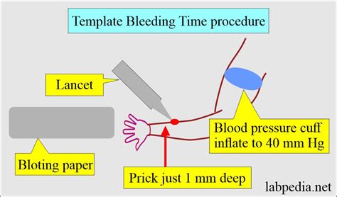 Bleeding Time (BT) - Labpedia.net