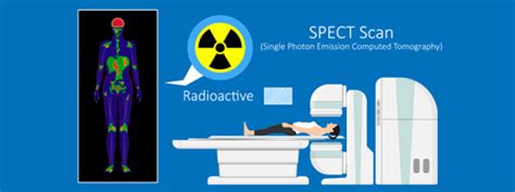 SPECT Scan: Procedure, Risks And Results