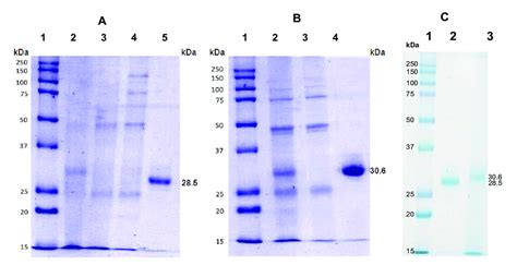 Polyacrylamide gel electrophoresis (SDS-PAGE) of the purification steps... | Download Scientific ...