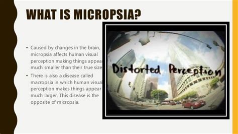 Micropsia