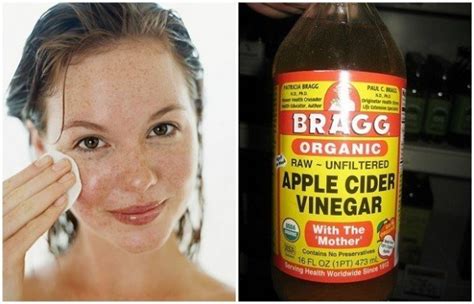 10 Unknown Side Effects of Apple Cider Vinegar - Updated 2023